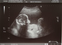 20-Week Scan